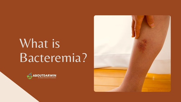Bacteremia vs Septicemia: What is Bacteremia?