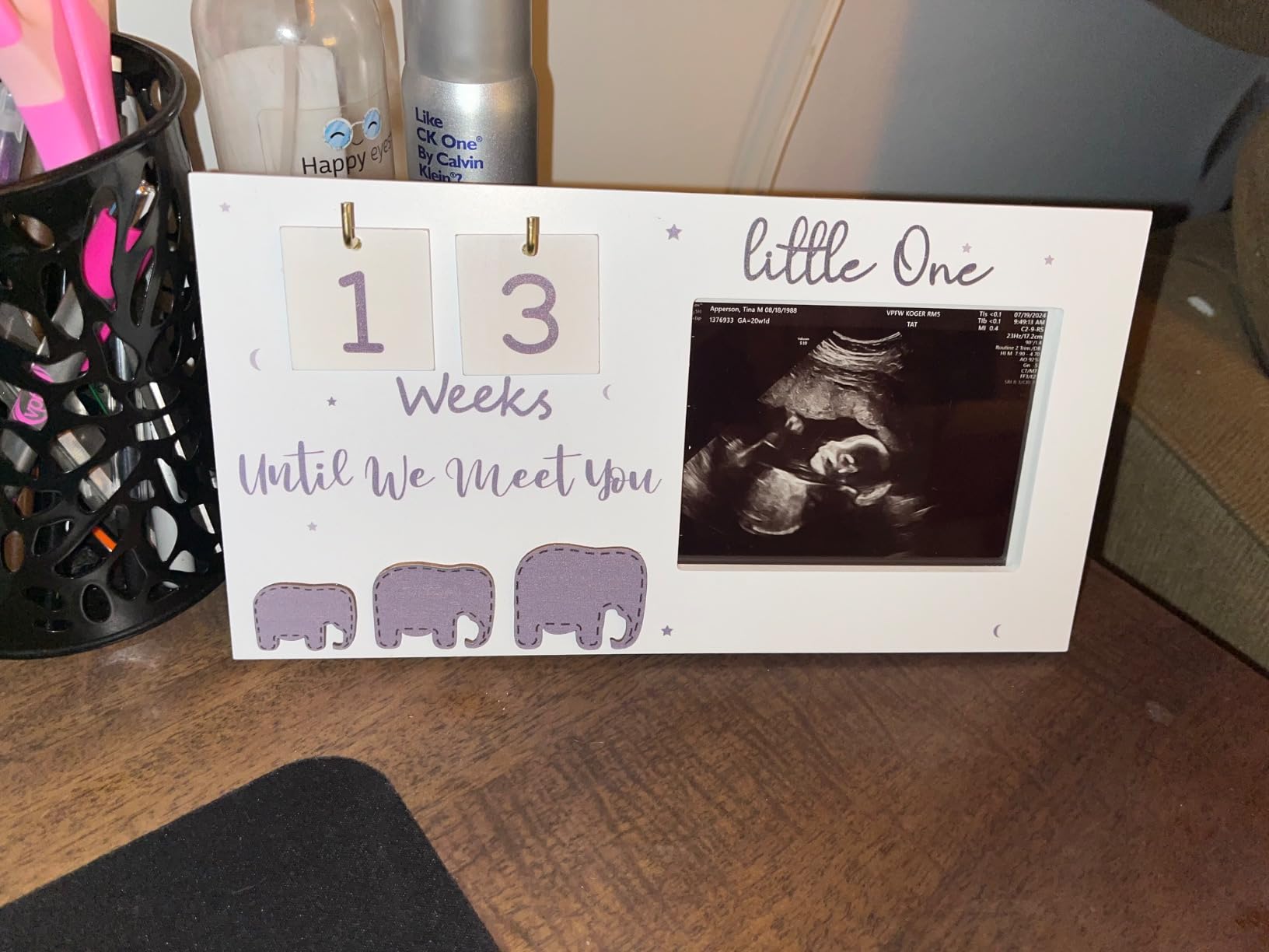 Sonogram Picture Frame, Ultrasound Photo Frame with Baby Countdown Weeks, Expecting Parents to be Pregnancy Gift Congratulations Pregnancy Must Have Grandparent Baby Announcement First Time Mom to Be Customer Review Sonogram Picture Frame, Ultrasound Photo Frame with Baby Countdown Weeks, Expecting Parents to be Pregnancy Gift Congratulations Pregnancy Must Have Grandparent Baby Announcement First Time Mom to Be - Customer Photo 1