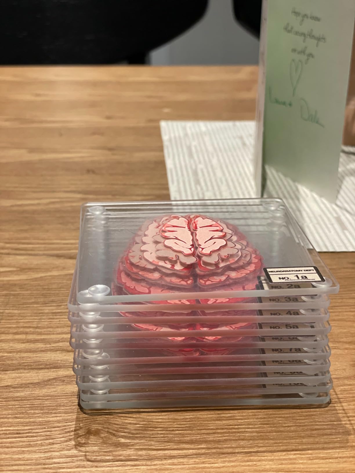 ThinkGeek Anatomic Brain Specimen Coasters Set of 10 for Neuroscience Medical Student Gifts Human Anatomy Generix geek customer photo 1